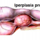 DISPONIBILE PRESSO ACV TRIGGIANO TEST CPSE (Esterasi Prostatica Canina Specifica)
